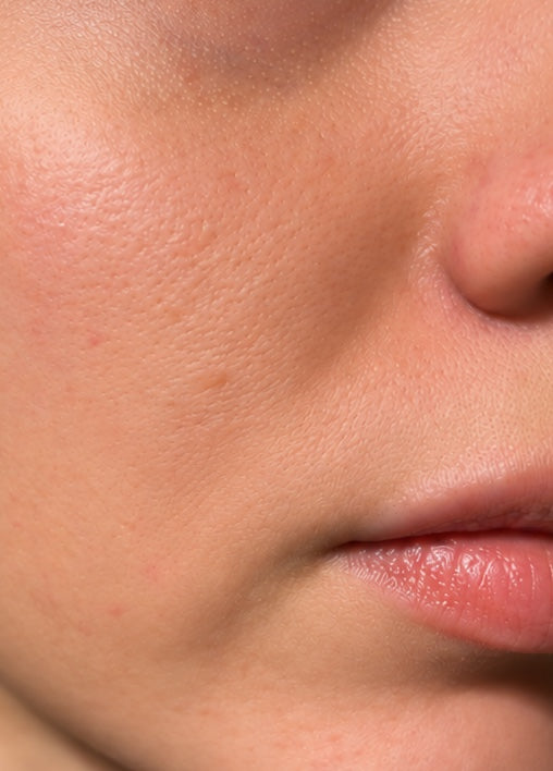 The same skin looking matte after one Buvard sheet