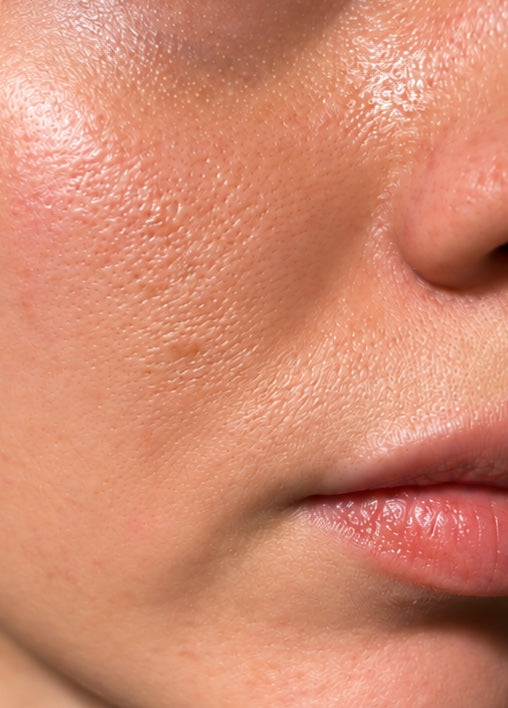 Close-up of oily, shiny skin before using Buvard